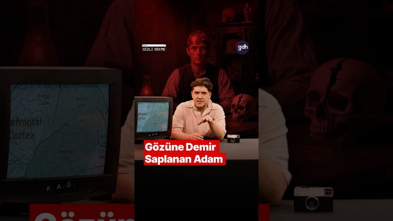 İnsan Ruhunun Şifresi Beynimizde mi? Tıp Dünyasını Şoke Eden Kaza! thumbnail
